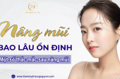 Nâng mũi bao lâu ổn định? Một số thắc mắc sau nâng mũi - Bác sĩ Trung giải đáp