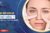 Nâng mũi gom lại có thấp không? Bao lâu vào form