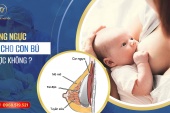 Sau nâng ngực có cho con bú được không? Bác sĩ giải đáp