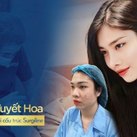 Dáng mũi Trung Hoa – Xu hướng này có thực sự phù hợp với người Việt?