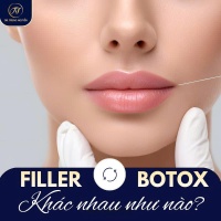 Filler và Botox: khác nhau thế nào? Hiểu rõ để tránh nhầm lẫn