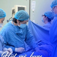 Sau sinh bao lâu thì hút mỡ bụng được? Thời điểm an toàn & hiệu quả