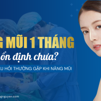 Nâng mũi 1 tháng đã ổn định chưa? Một số câu hỏi thường gặp khi nâng mũi - Bác sĩ Trung Nguyễn