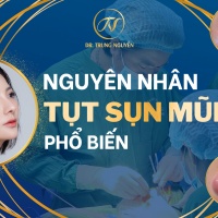 Nguyên nhân tụt sụn mũi phổ biến hiện nay - Bác sĩ Trung Nguyễn