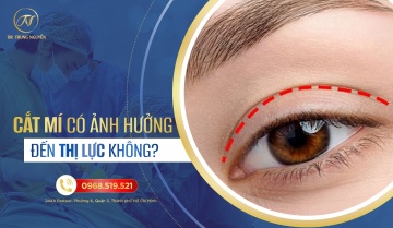 Cắt mí mắt có ảnh hưởng đến thị lực không?