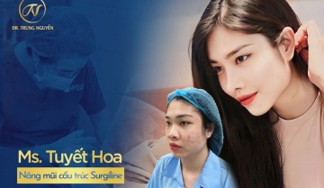 Dáng mũi Trung Hoa – Xu hướng này có thực sự phù hợp với người Việt?