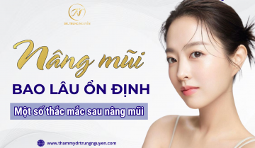 Nâng mũi bao lâu ổn định? Một số thắc mắc sau nâng mũi - Bác sĩ Trung giải đáp