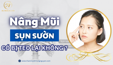 Nâng mũi sụn sườn có bị teo lại không? - Tìm hiểu ngay