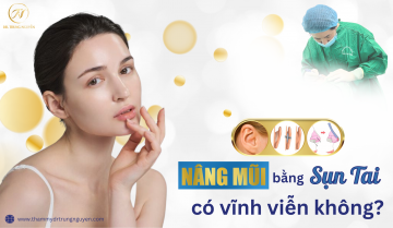 [Giải đáp] Nâng mũi sụn tai có vĩnh viễn không - Bác sĩ Trung Nguyễn