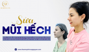 Đâu là phương pháp sửa mũi hếch an toàn, vĩnh viễn?