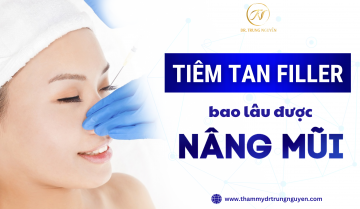 Giải đáp: Tiêm tan filler bao lâu thì nâng mũi được?