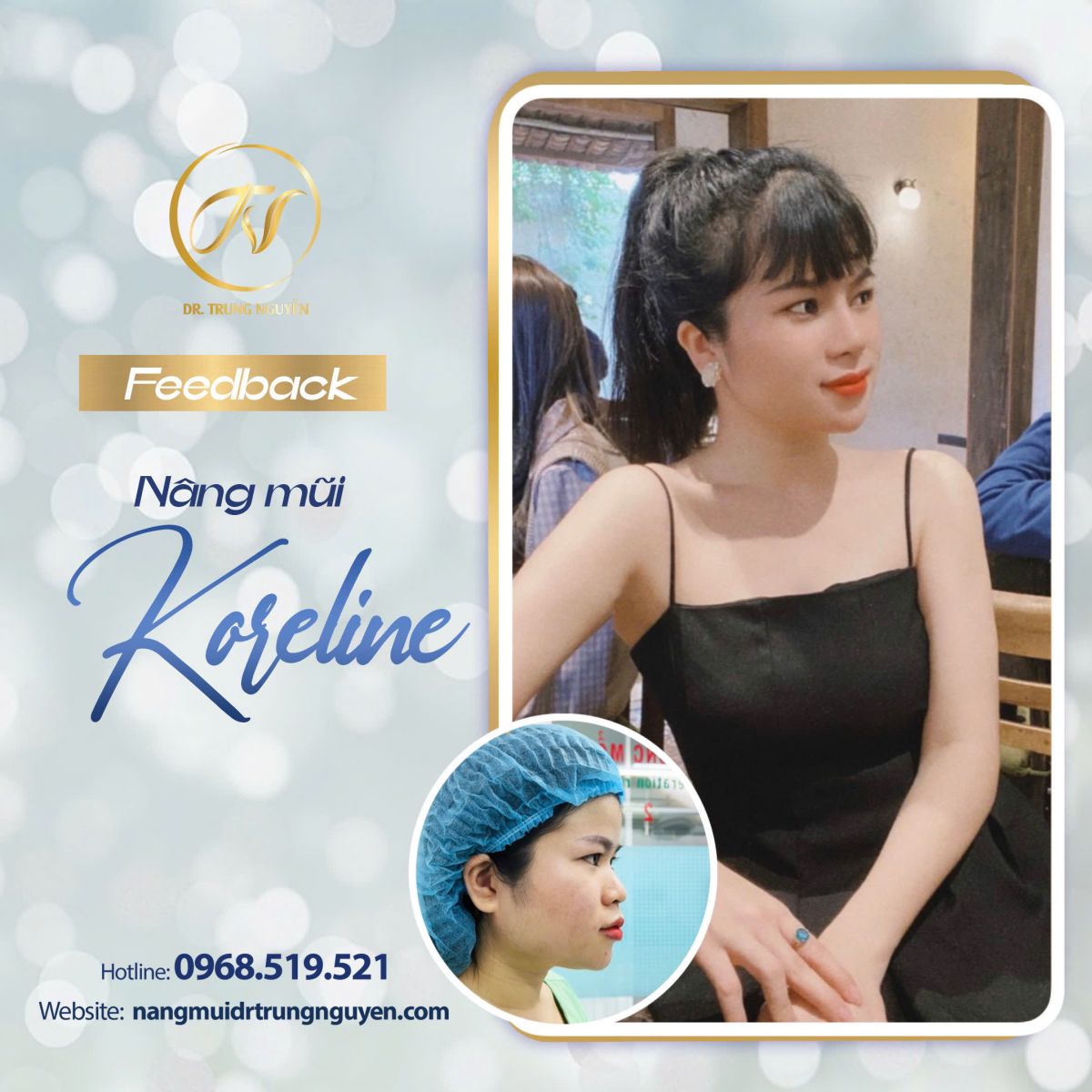 Bác sĩ Trung Nguyễn – người trực tiếp thực hiện và theo dõi tuổi thọ nâng mũi lâu dài