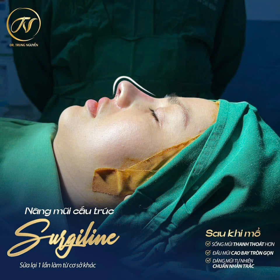 Dáng mũi Trung Hoa hiện đại chú trọng sự thanh thoát và tỷ lệ hài hòa.