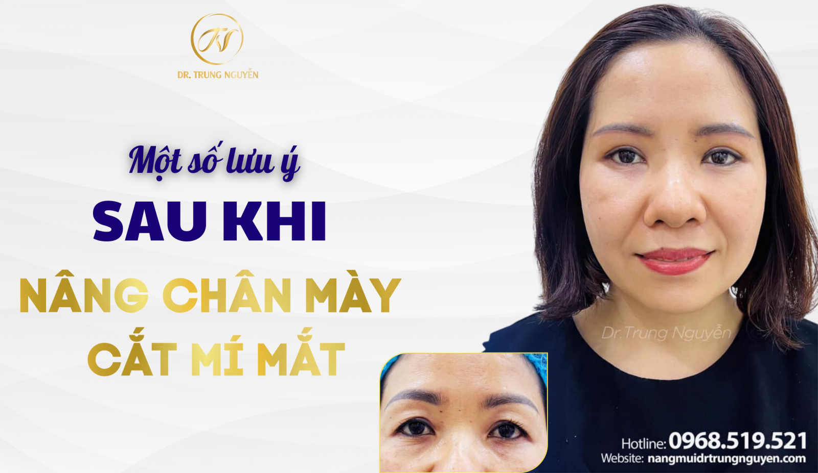 Một số lưu ý sau khi nâng chân mày và cắt mí